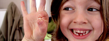 Caída prematura de un diente de leche: por qué ocurre y qué consecuencias puede tener para el desarrollo bucodental del niño
