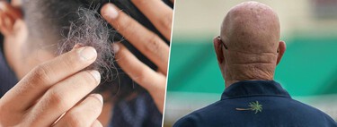 Há anos ouvimos dizer que lavar o cabelo em excesso causa queda, mas é exatamente o contrário 