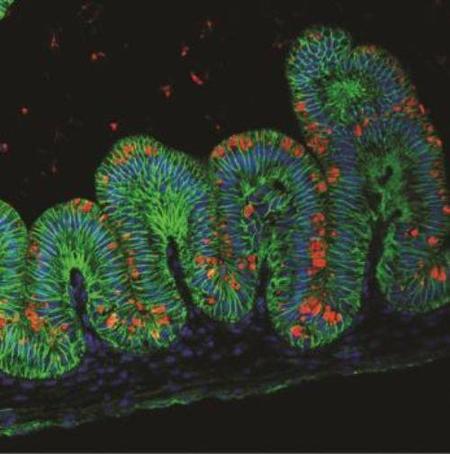 Primeros ‘miniestómagos’ humanos creados con células madre