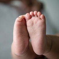 Síndrome del torniquete en los bebés: hilos y pelos pueden ser peligrosos 