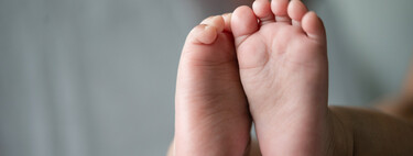 Síndrome del torniquete en los bebés: hilos y pelos pueden ser peligrosos 