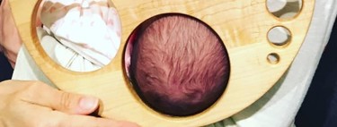 Estos son diez centímetros de dilatación: así se adapta el cuello uterino para que el bebé pueda nacer