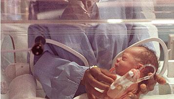 La leche materna es ideal para el desarrollo intelectual de los niños muy prematuros
