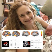 El embarazo encoge el cerebro pero lo hace más fuerte: una neurobióloga se hizo 26 resonancias para crear el primer mapa detallado del cerebro durante la gestación