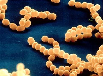 Recomendaciones sobre la infección por estreptococos en embarazadas