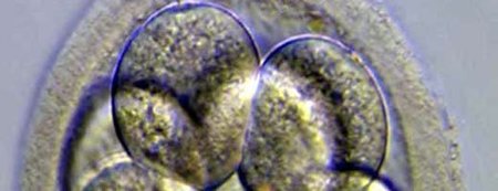 Embryoscope, el futuro de la fecundación in vitro