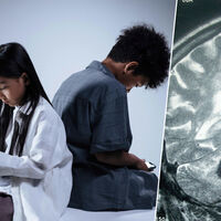 ¿Qué le hace exactamente el smartphone al cerebro de un adolescente? Un hospital de Málaga se ha propuesto medirlo 