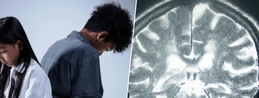 La investigación pionera en Málaga con adolescentes: ya no buscan la adicción al móvil, sino la "cicatriz" física que deja en el cerebro