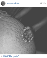 Loveyourlines ("Ama tus estrías"), las marcas de la maternidad son furor en la red 