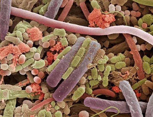 Bacteria On The Surface Of A Human Tongue