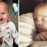 Una persona anónima paga la operación de fisura labial de un bebé tras ver que se burlaban de él en las redes