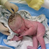 Circular de cordón, ¿qué pasa si se enreda el cordón en el cuello del bebé?