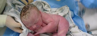 Circular de cordón, ¿qué pasa si se enreda el cordón en el cuello del bebé?