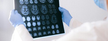 Cada vez más empresas están desarrollando chips cerebrales. California quiere proteger nuestra información neuronal con una ley 