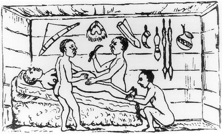 Breve historia de la cesárea