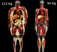 ¿De verdad sigues pensando que un niño gordito está más sano?