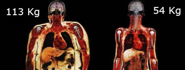 ¿De verdad sigues pensando que un niño gordito está más sano?