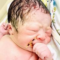 La verdad sobre la foto viral del bebé recién nacido con un DIU agarrado en la mano, ¿es posible? 