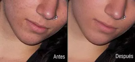 antes-despues-1.jpg