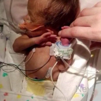 El emotivo "club de los abrazos" que ha contribuído a que un bebé prematuro logre salir adelante