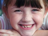 Un golpe en un diente: graves consecuencias