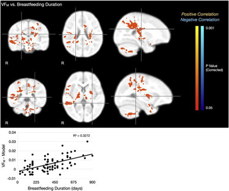 Cerebro de niño según el tiempo de lactancia