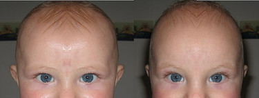 Probabilidades de tener gemelos