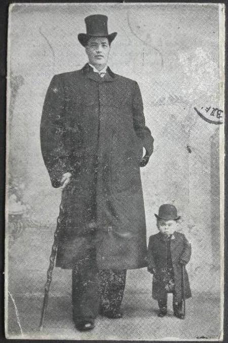 La única persona de la historia médica que pasó de enano a gigante