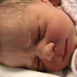 Cafeína para tratar a bebés prematuros