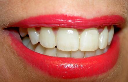 Dientes más blancos con unos sencillos gestos