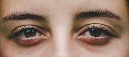 Glaucoma: qué es, cómo se detecta y qué puedes hacer para prevenirlo