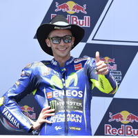 Sin complicaciones, Valentino Rossi podrá recibir el alta médica esta misma tarde