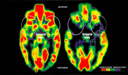 ¿Cómo afecta el estilo de crianza de los padres al desarrollo cerebral de los hijos?
