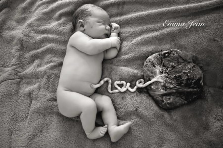 La preciosa foto de un bebé, su placenta y el cordón diciendo "Love"