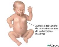 La "leche de brujas" del recién nacido