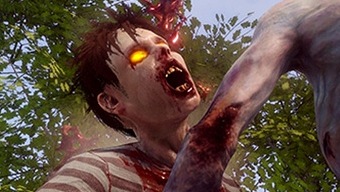 State of Decay 2 soportará tasas de refresco variables en Xbox One